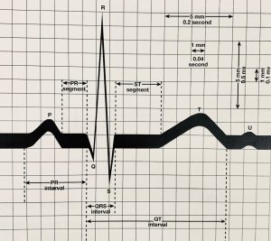 MOR Safety Service Fairfield | EKG Class